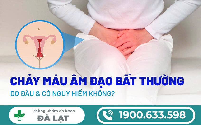 Hình ảnh minh họa